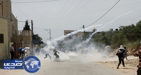 إصابة مراسل تلفزيون فلسطين برصاص قوات الاحتلال الصهيوني بكفر قدوم