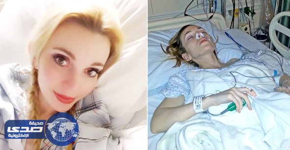 أمريكية تٌعاني من الآلآم مدة 35 عاما .. والسبب ” العفن الأسود “