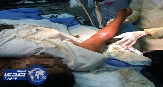 بالصور .. مدني بيش يخرج يد عامل احتجزت في خزان لمعدة ثقيلة