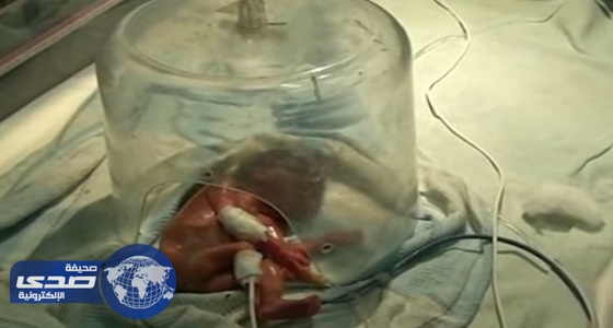 بالفيديو .. رضيعة تعود للحياة قبل حرقها بالهند