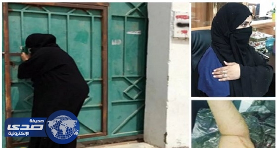 الهيئة العمالية تؤجل قضية صاحبة الذراع المبتور