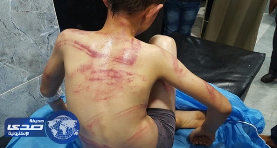 بالصور.. أب عراقي يعذب ابنه ويحبسه دون طعام