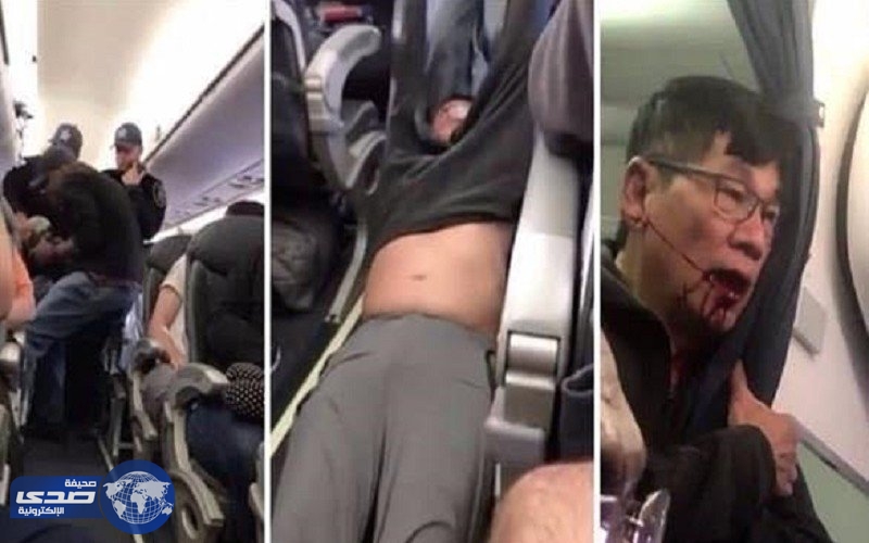 وقف ضابطين بمطار شيكاغو لتورطهما بواقعة الراكب المسحول