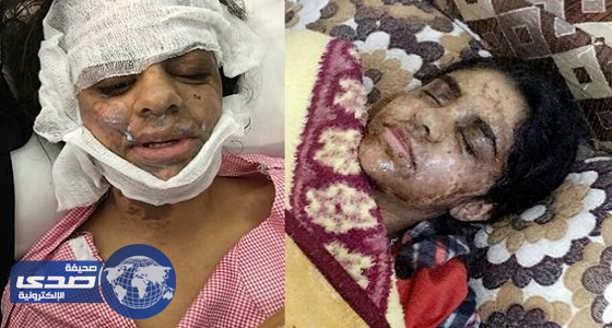 بالفيديو..التعليم توضح تفاصيل جديدة في واقعة «تشوه طالبتين»