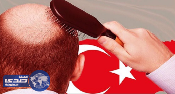 آلآف السعوديون يلجأون لتركيا لإجراء عملية زرع شعر.. لانخفاض تكلفتها
