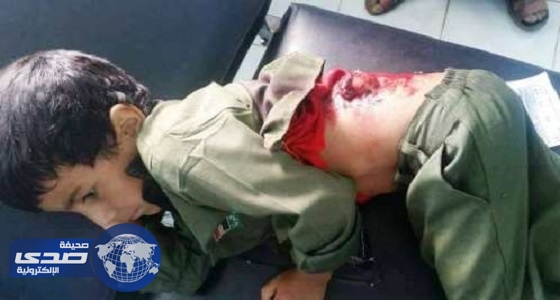 إصابة طفلين بصاروخ كاتيوشا أطلقه الحوثيون على مأرب