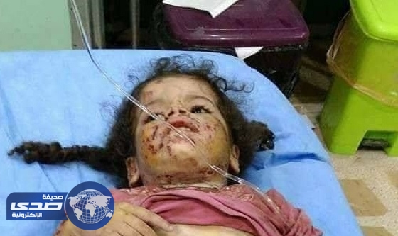 عراقي ينهش جسد طفلتيه بأسنانه