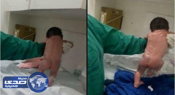 بالفيديو.. بعد دقائق من ولادته .. طفل يبدأ المشي على قدميه