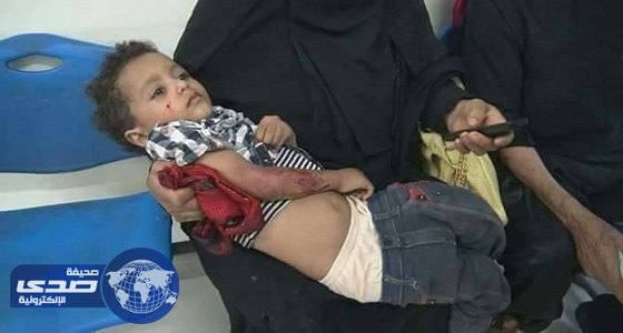 ⁠⁠⁠⁠⁠بالصور.. مصرع واصابة العشرات في مجزرة حوثية شمالي صنعاء