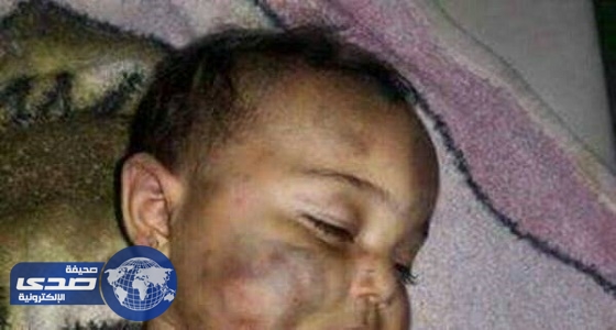 أب سوري ينهش جسد طفلته الرضيعة لشعوره بالعار