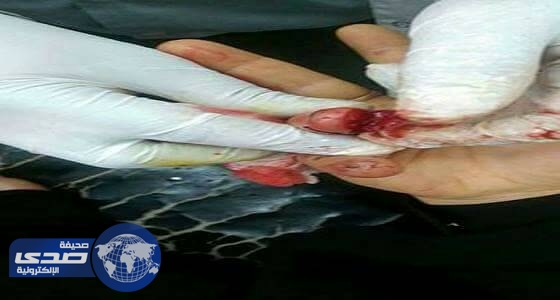 بالصور.. الانقلابيون ينهبون منزل أسرة و يعتدون بالضرب على نسائها في صنعاء