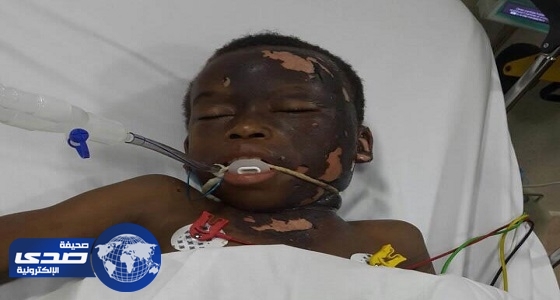 بالصور.. الكهرباء تباشر واقعة صعق طفل بأسلاك ضغط عالي في جازان
