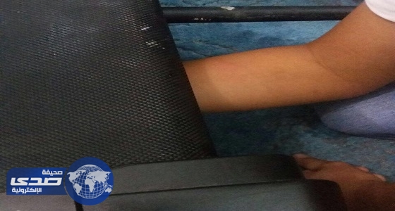 مدني العلا ينقذ يد طفل دخلت في جهاز سير رياضي