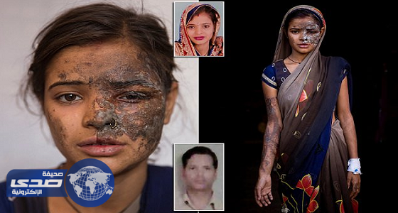 أب يحرق ابنته وزوجها لأكتشافها بيعه فتيات لآخرين لممارسة الجنس معهن