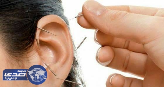 الوخز بالإبر ينهي آلام المرضى في أقسام الطوارئ