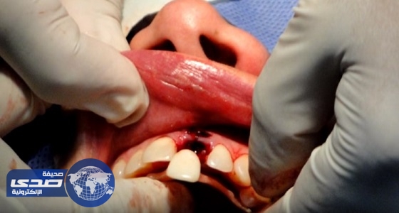 بالفيديو.. 7 قصص مرعبة داخل عيادات الأسنان