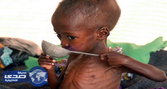 الأمم المتحدة: 20 مليون جائع في العالم بسبب العنف