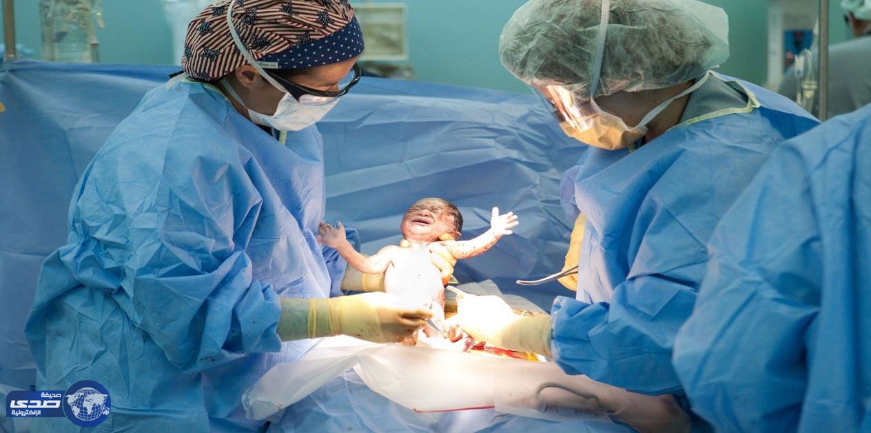 تسجيل أول حالة ولادة بشرية في العالم “ بلا جنس ”