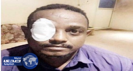 عامل يفقد نصف بصره بعد شجار بـ ” العقال الطائر ” في جدة