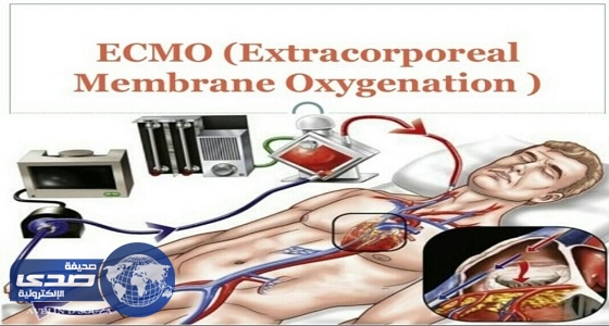 إطلاق خدمة الإيكمو في عسير