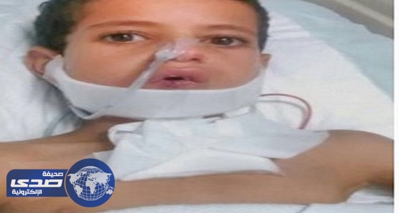 مركز الملك سلمان للإغاثة يبادر بعلاج طفل يمني أصيب بقذيفة حوثية