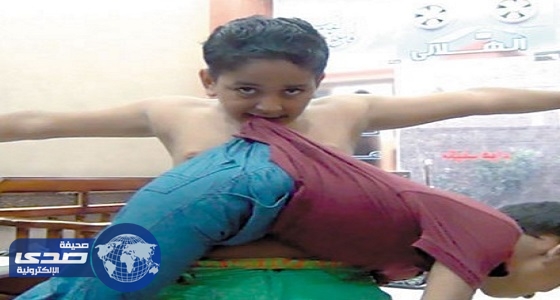 بالفيديو والصور.. ” الخارق الصغير ” طفل مصري يقهر النار وجسده لا ينزف