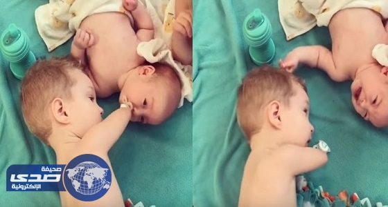 بالفيديو.. طفل فاقد ذراعيه يٌساعد في تهدئة أخاه الرضيع