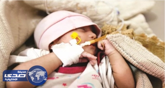 استمرار وباء الكوليرا في انتشاره باليمن