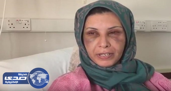 بالفيديو.. السورية المعنفة تكشف تفاصيل اعتداء طليقها البحريني عليها