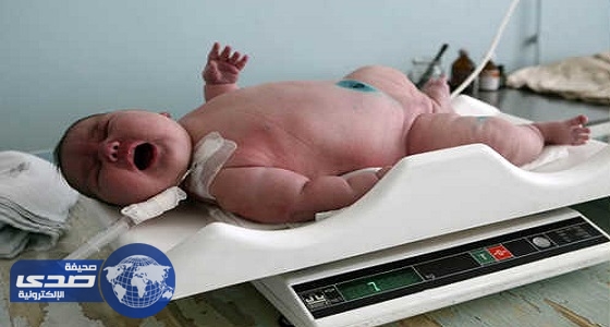 ولادة طفل يزن حوالي 6 كجم في مدينة روسية