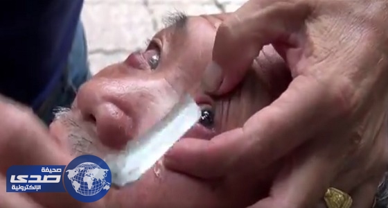 بالفيديو.. حلاق صيني ينظف عيون زبائنه بسكين