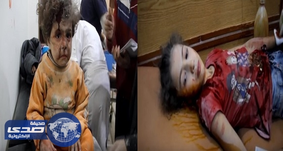 بالفيديو.. فيلم عن دمار سوريا يفوز بجائزة ” روري بيك “