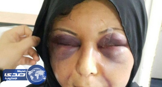 الحبس سنة لزوج السورية المعنفة زهراء صبحي