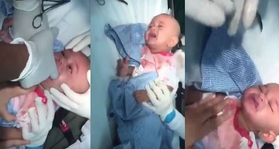 فيديو مروع لطبيب يزيل ساعة من حنجرة طفل صغير