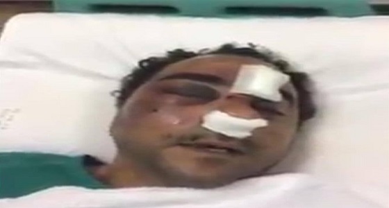 بالفيديو والصور.. ملابسات الاعتداء على عامل مصري بوحشية في الكويت