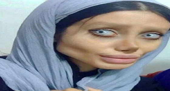 بالصور.. أرادت أن تشبه &#8221; أنجلينا جولي &#8220;.. فتاة إيرانية أصبحت شبحا مخيفا 