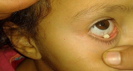 بالفيديو.. فتاة تذرف حجارة بدلًا من الدموع