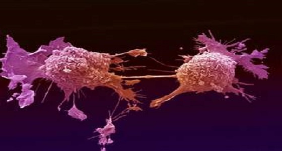 ابتكار علاج جديد للقضاء على الأورام السرطانية