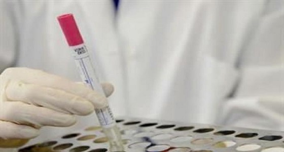 وفاة خامسة بمرض انفلونزا الخنازير في الأردن