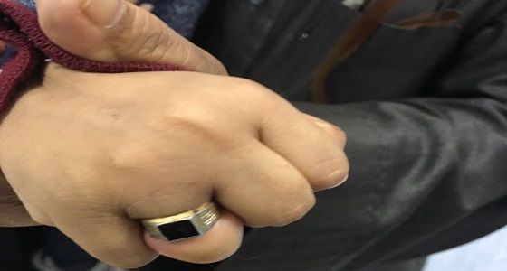 تحرير إصبع طفل علق بخاتم في حائل