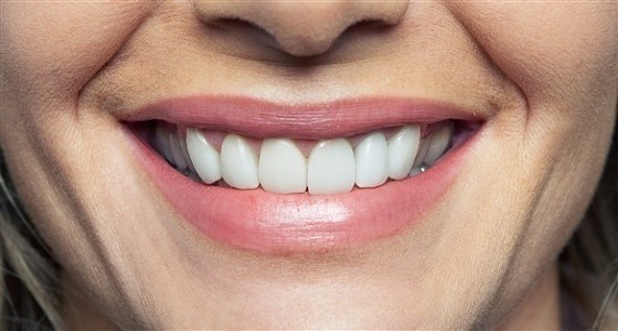 عادات شائعة تضعف الأسنان