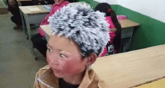 صورة طفل بشعر متجمد تثير ضجة بمواقع التواصل
