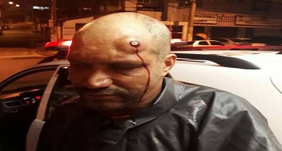 مدرب رماية برازيلي يبقى حيًا بعد طلقة رصاصية برأسه