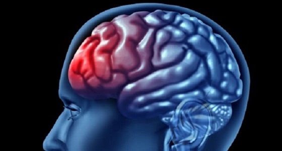 أسباب و أعراض الإصابة بنزيف المخ