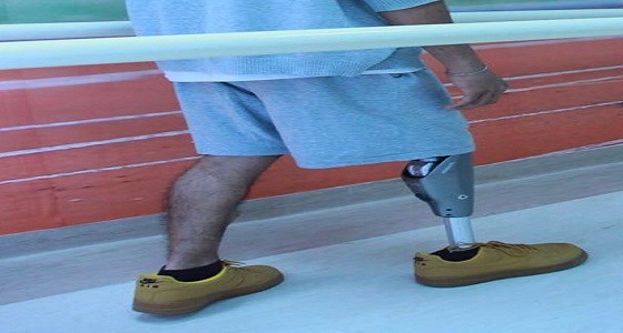 &#8221; سعود الطبية &#8221; تنجح في تركيب ركبة إلكترونية تعمل بالبلوتوث