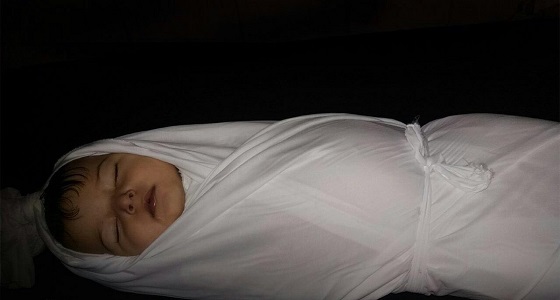 وفاة طفلة سورية لم تتجاوز العام ونصف لقلة الرعاية الصحية