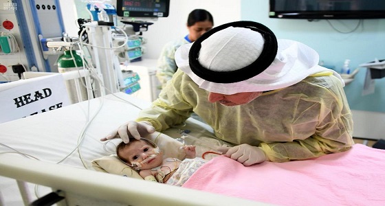 استقرار حالة الطفلة &#8221; حنين &#8221; بعد 4 أيام من عملية انفصال التوأم الطفيلي