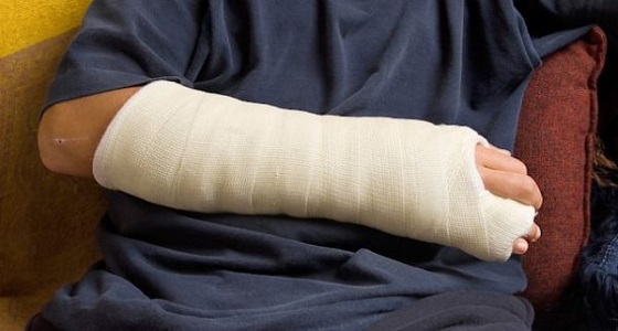 امراة مسنة تحمل 3 أساور أعاقت علاج كسر يدها بالقنفذة
