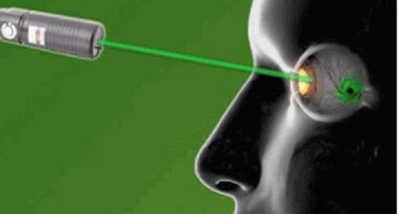 أشعة الليزر مضرة للعين وتؤدي لمضاعفات خطيرة