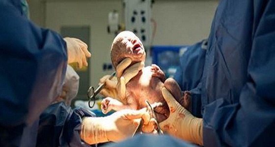 ” الصحة العالمية ” تحذر من التدخلات التي تسرع عمليات الولادة
